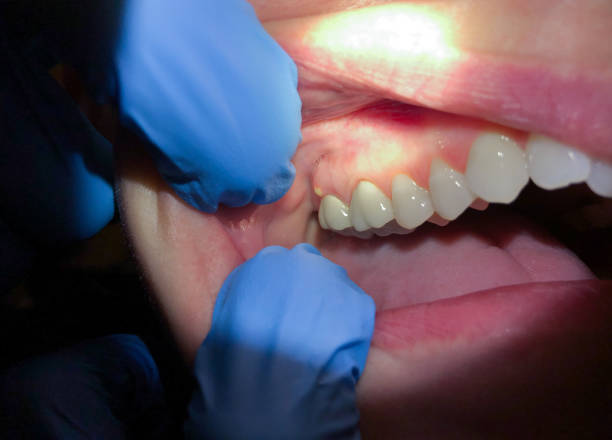 Best Emergency Dental Surgery in Cleary, MS